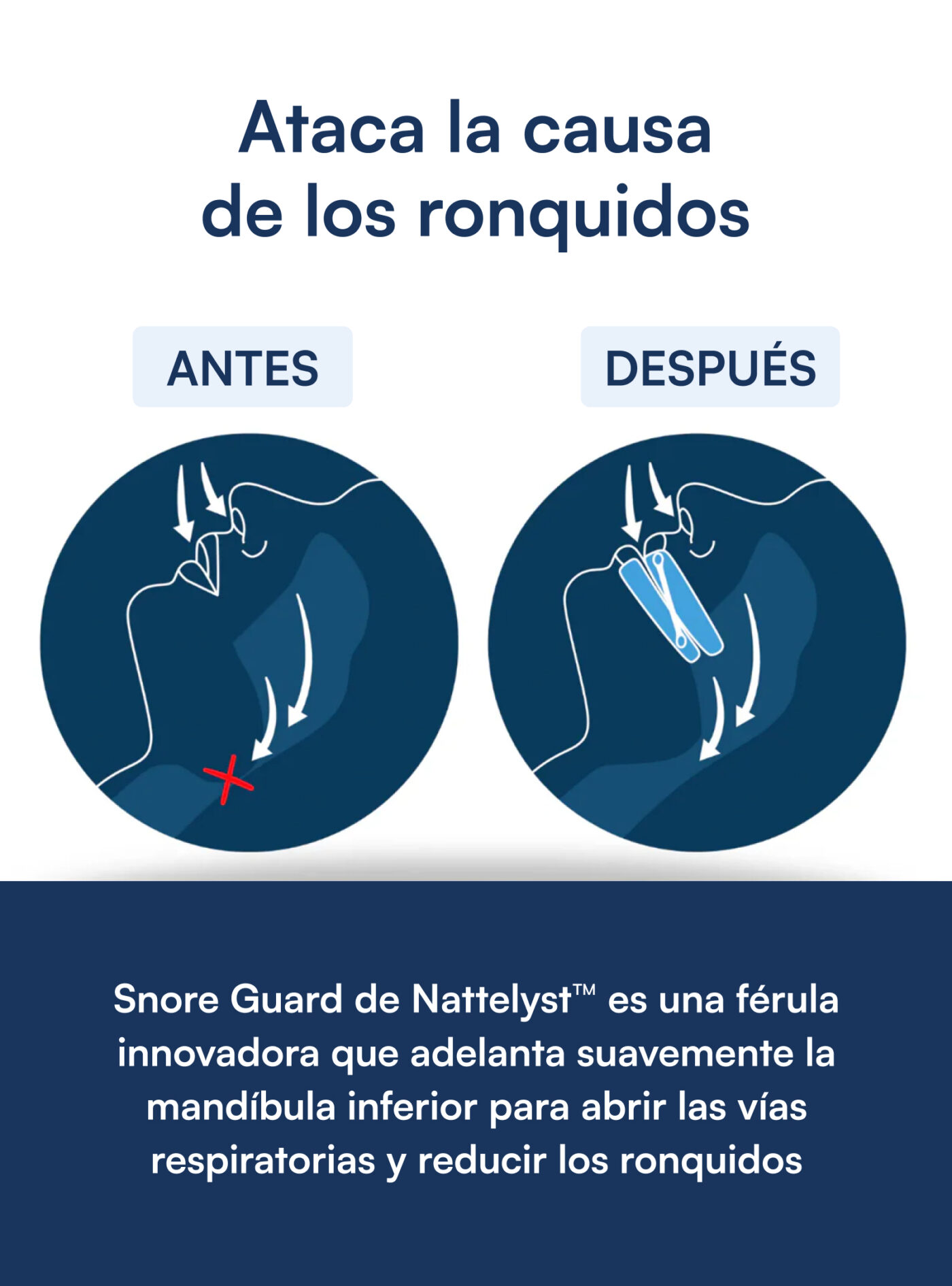 Pack antirronquidos
