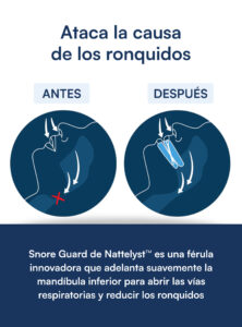 Pack antirronquidos